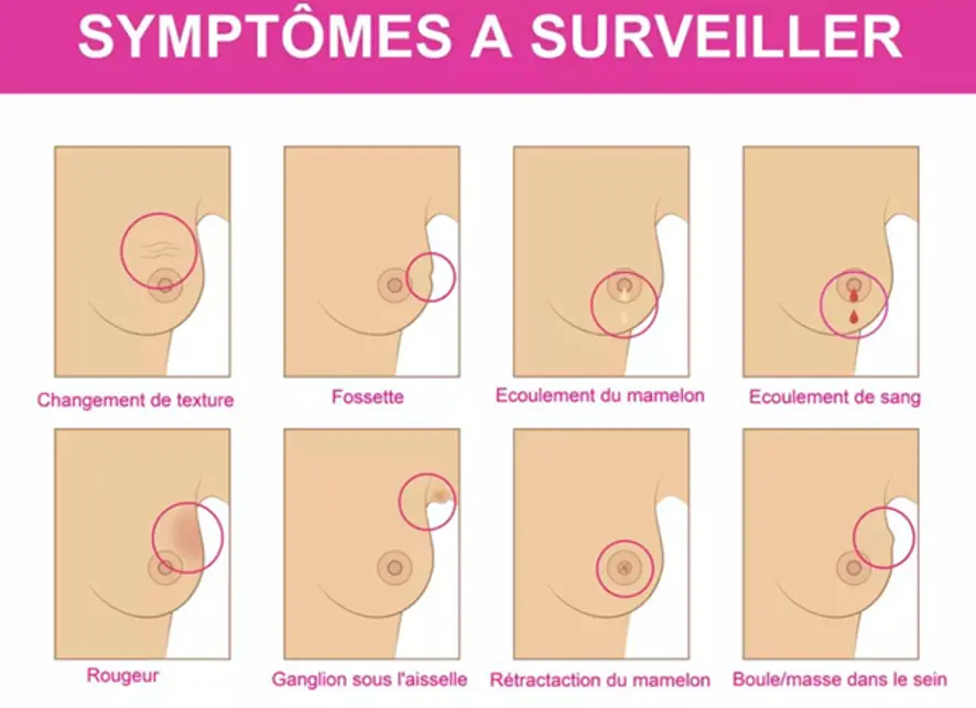 Les symptômes à surveiller 